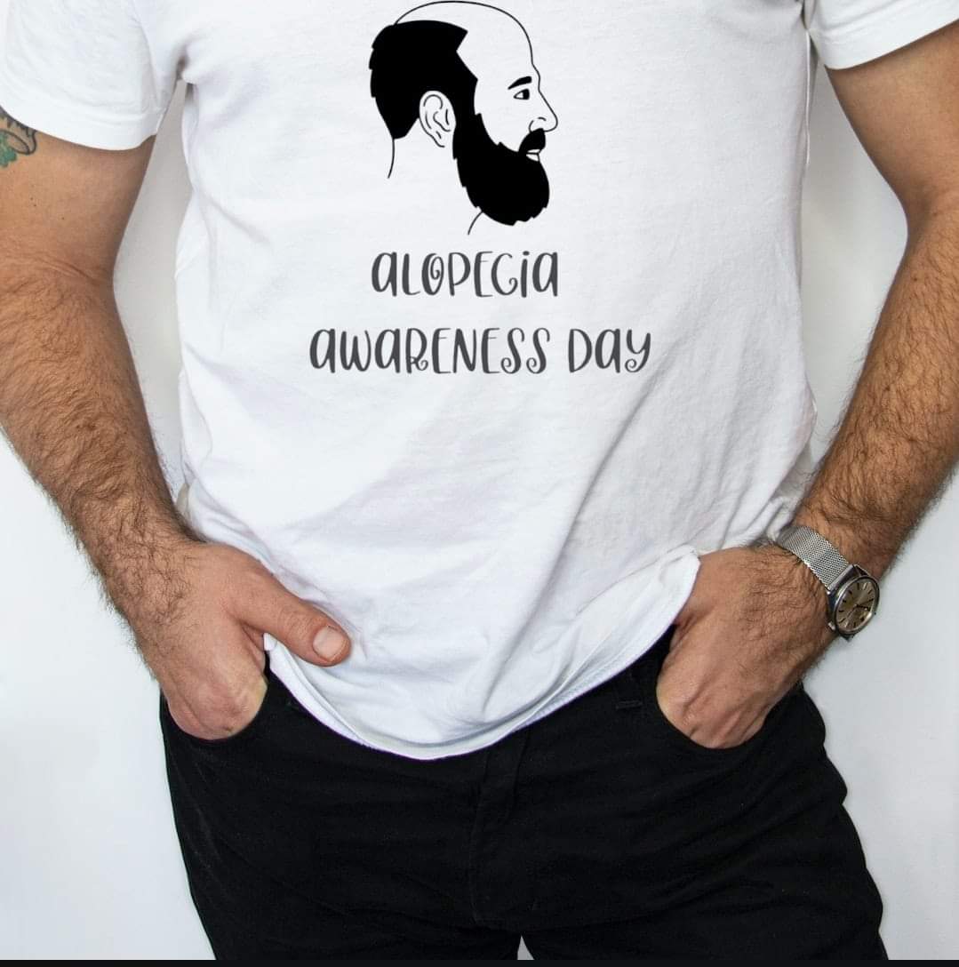 Alopecia Areata Awareness T-shirt - Benefits Charity